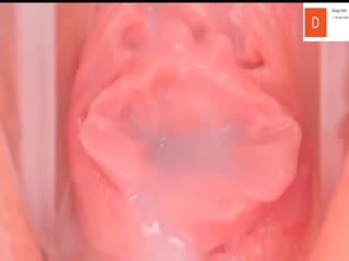 国产自拍珍稀资源某美容美体医院内部流出高清内窥镜下女性阴道内部